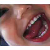 Figurinha de reação para WhatsApp